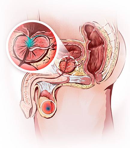 Союз-Аполлон